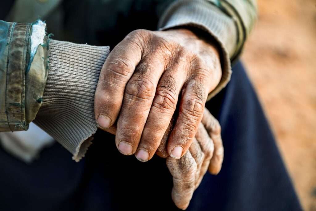 mãos de idoso, uma sobre a outra.